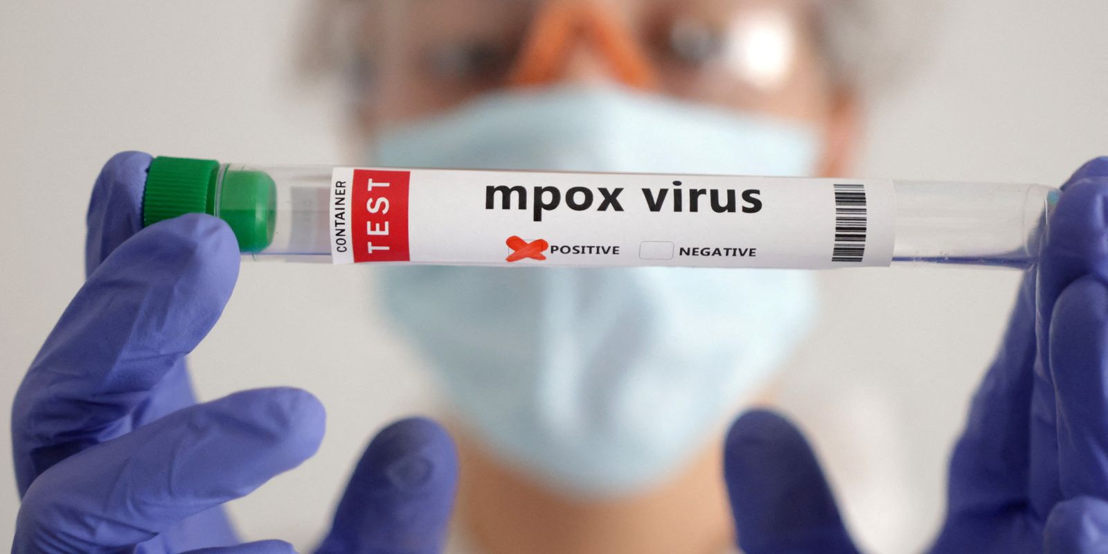 Brasil supera marca de mil casos de mpox em 2024