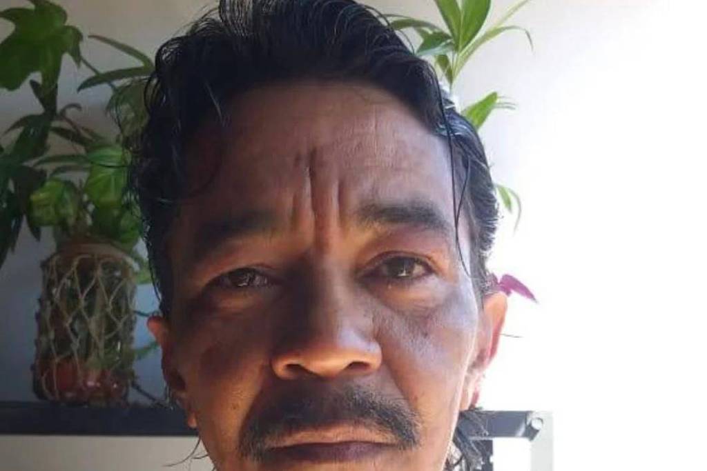 Morre sobrevivente do acidente com o césio-137 em Goiás